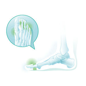 Ecarteur des cinq orteils en silicone OP 6723